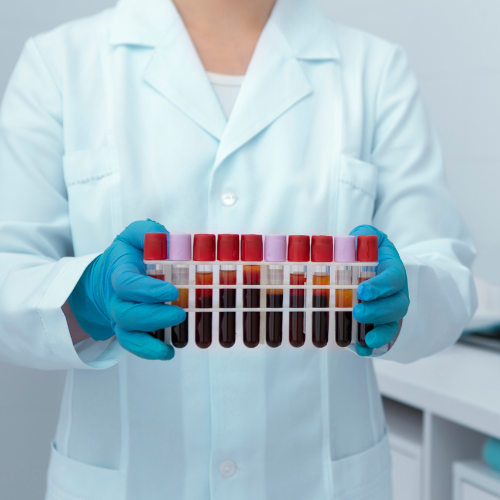 Understanding A1C