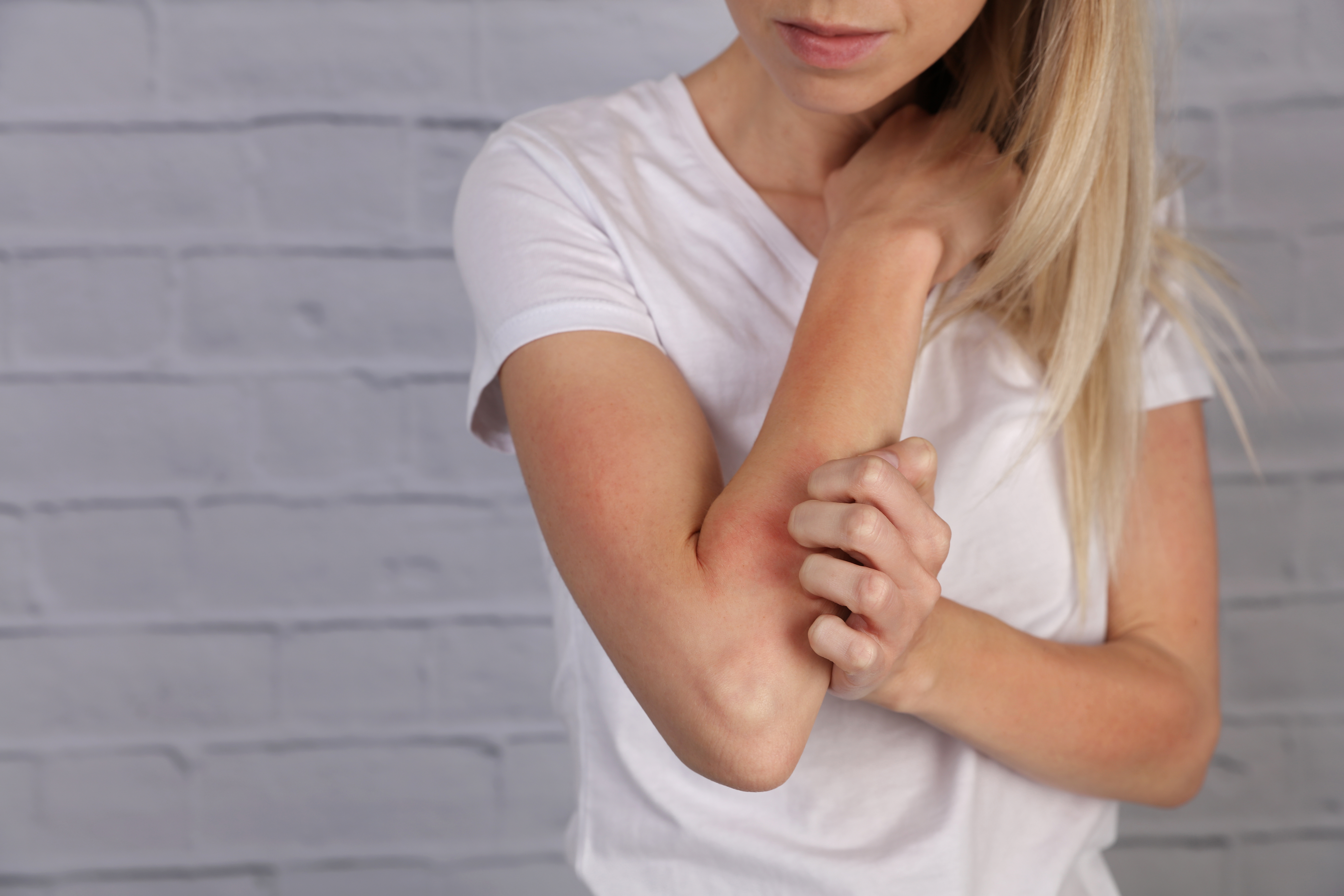 Eczema and Gut-Health: a Relationship That’s More than Skin Deep￼